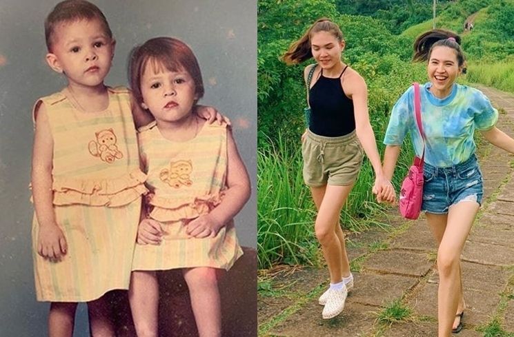 Dari Cornnell Twins Sampai Tasya Tasyi Simak Potret Dulu Dan Kini