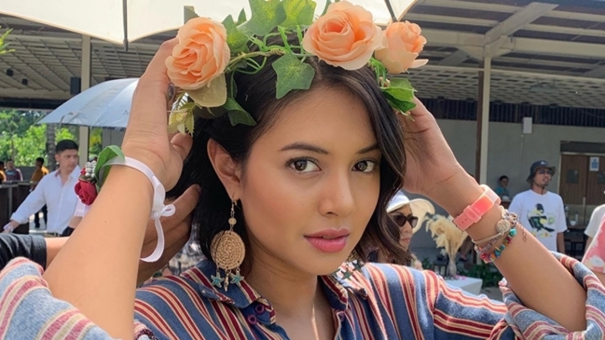 Aurelie Moeremans Bawa Kabar Buruk, Bagian Otaknya Menyusut Imbas Kecelakaan