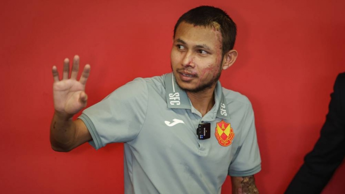 Muncul ke Publik usai Disiram Air Keras, Begini Kondisi Bintang Timnas Malaysia Faisal Halim