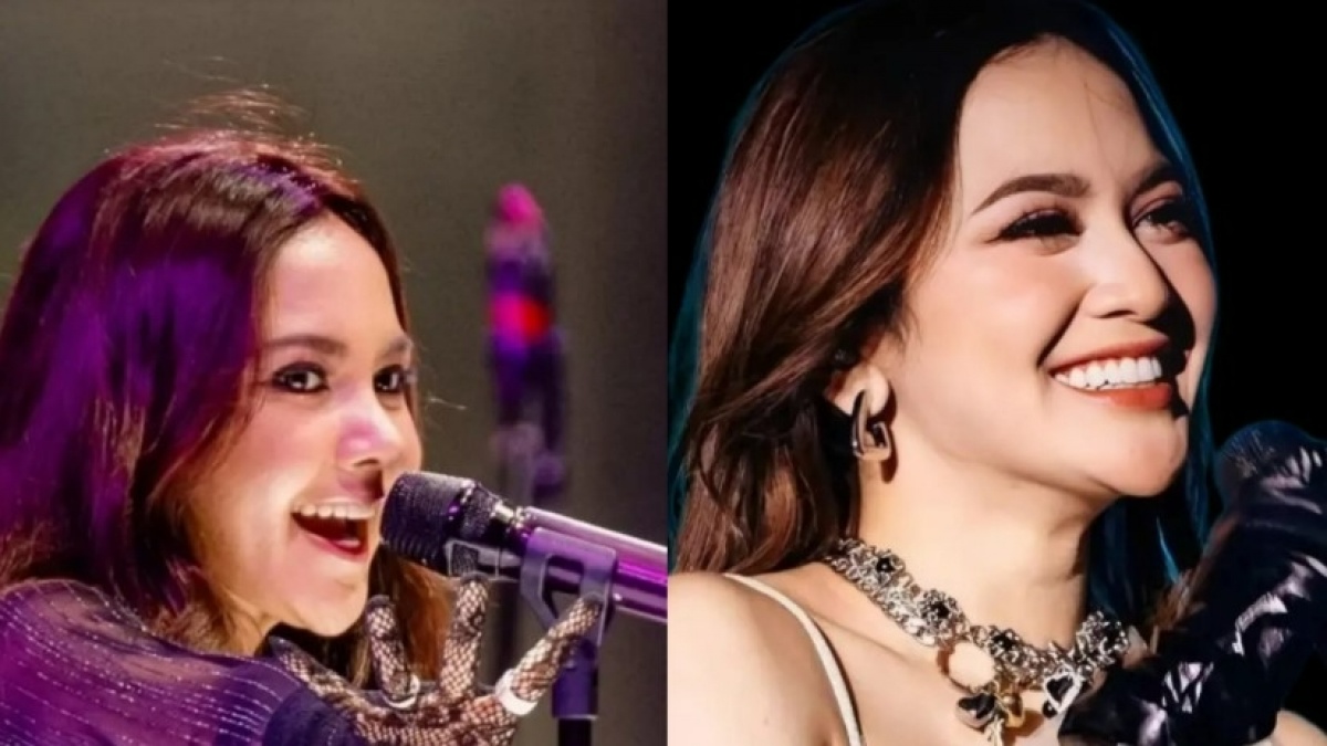 Beda Penampakan Before-After Wajah Sarwendah vs Mahalini usai Operasi Plastik