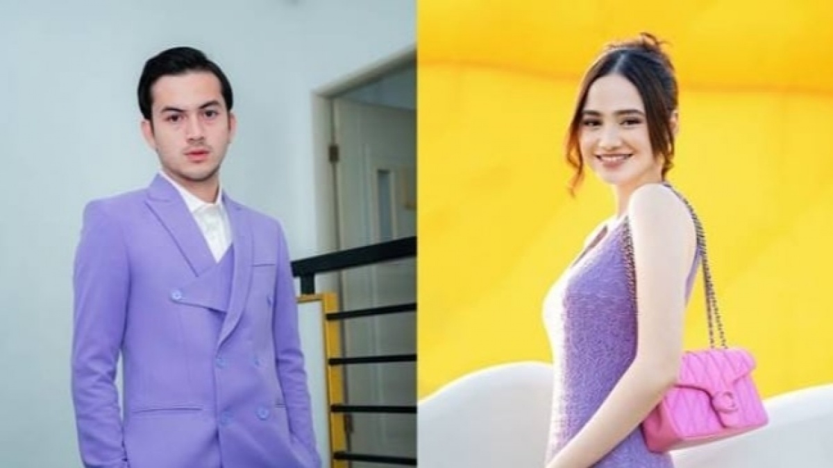 Rambut Rizky Nazar Dicurigai Makin Menipis Usai Putus dari Syifa Hadju, Dibilang Gejala Kebotakan Dini