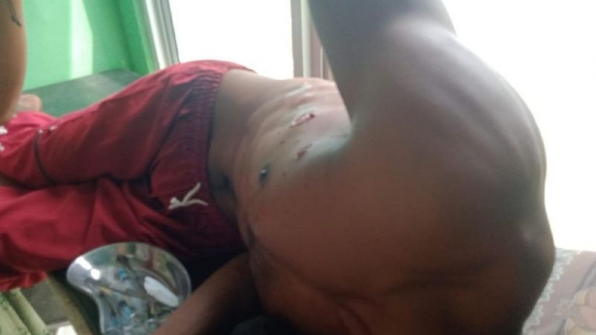 Terluka Parah, Warga Mukomuko Digigit Buaya di Sungai Air Hitam