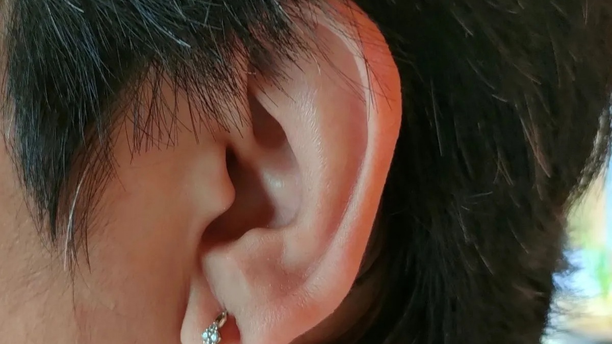 Telinga Berdenging Terus? Kenali Gejala Tinnitus dan Penyebabnya Agar Terhindar dari Masalah Pendengaran Serius!