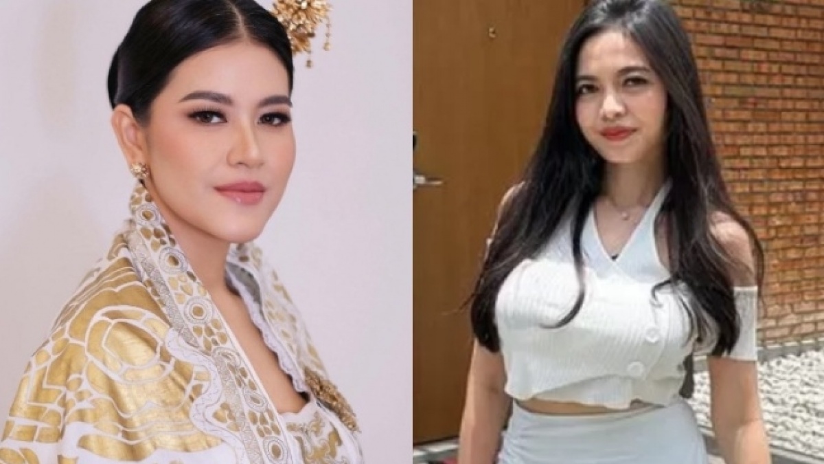 Beda Jauh Circle Kahiyang Ayu dan Clara Wirianda, Perempuan yang Dituding Dekat dengan Bobby Nasution