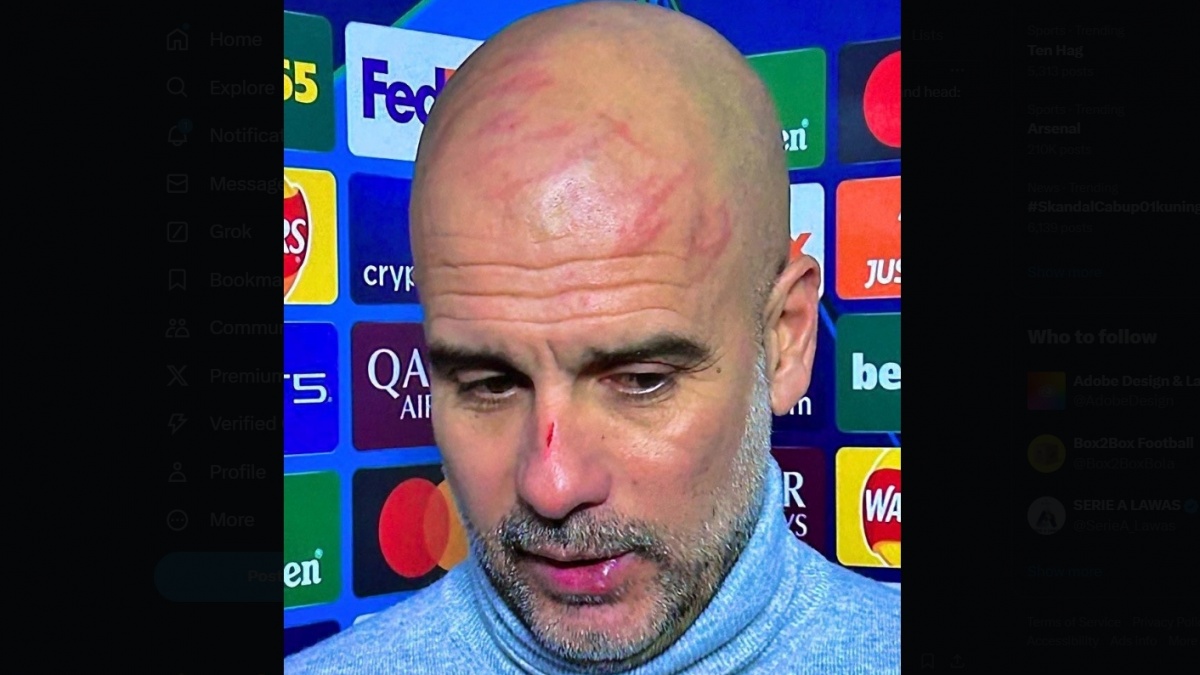 Ruang Ganti Memanas: Dua Kiper Man City Mau Cabut Januari, Pep Guardiola Pusing