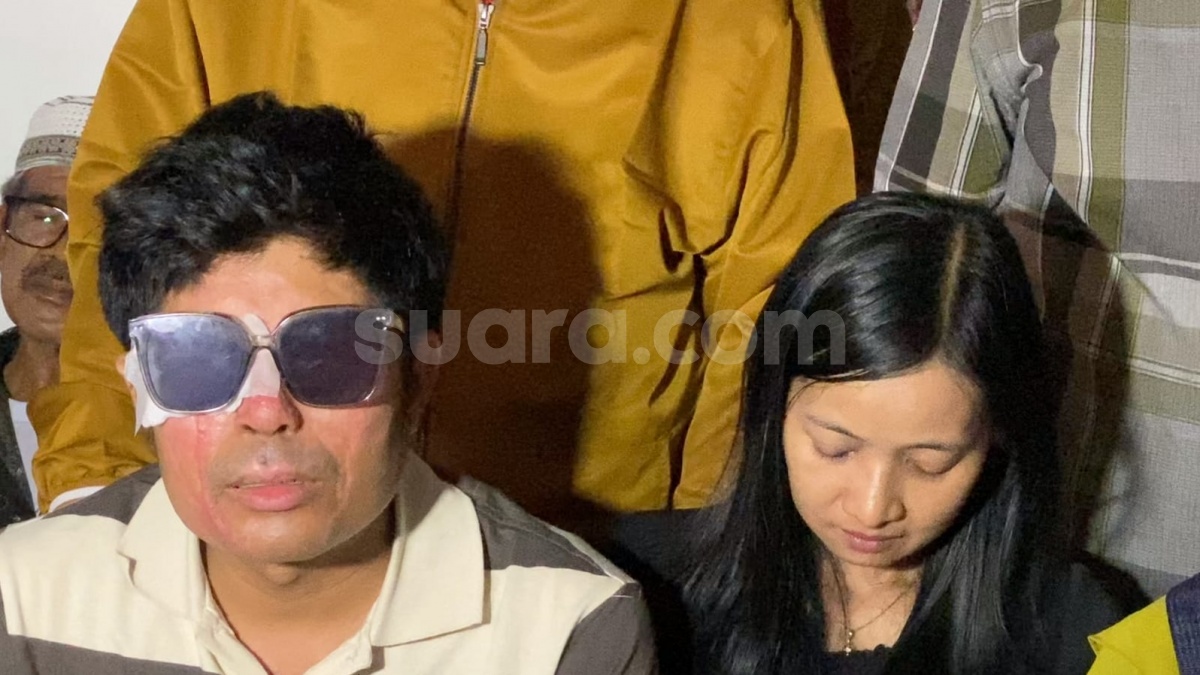 Kasus Air Keras Agus Salim: Dari Iba Netizen, Kontroversi Hingga Dicibir Publik
