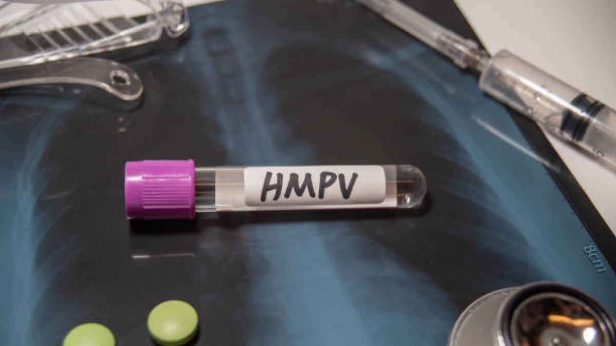 Bagaimana Cara Membedakan Virus HMPV dengan RSV: Dua Infeksi Pernapasan Bergejala Mirip