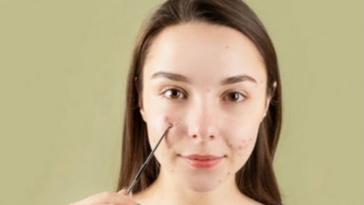 Urutan Skincare Malam Viva untuk Hempas Jerawat, Praktis Hanya 4 Langkah dan Harga Terjangkau