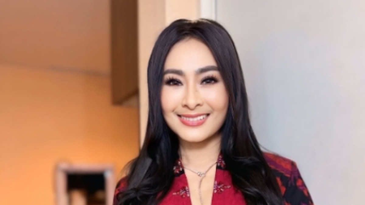 Segini Kekayaan Iis Dahlia yang Facelift Gratis di Korea, Hobi Koleksi Berlian