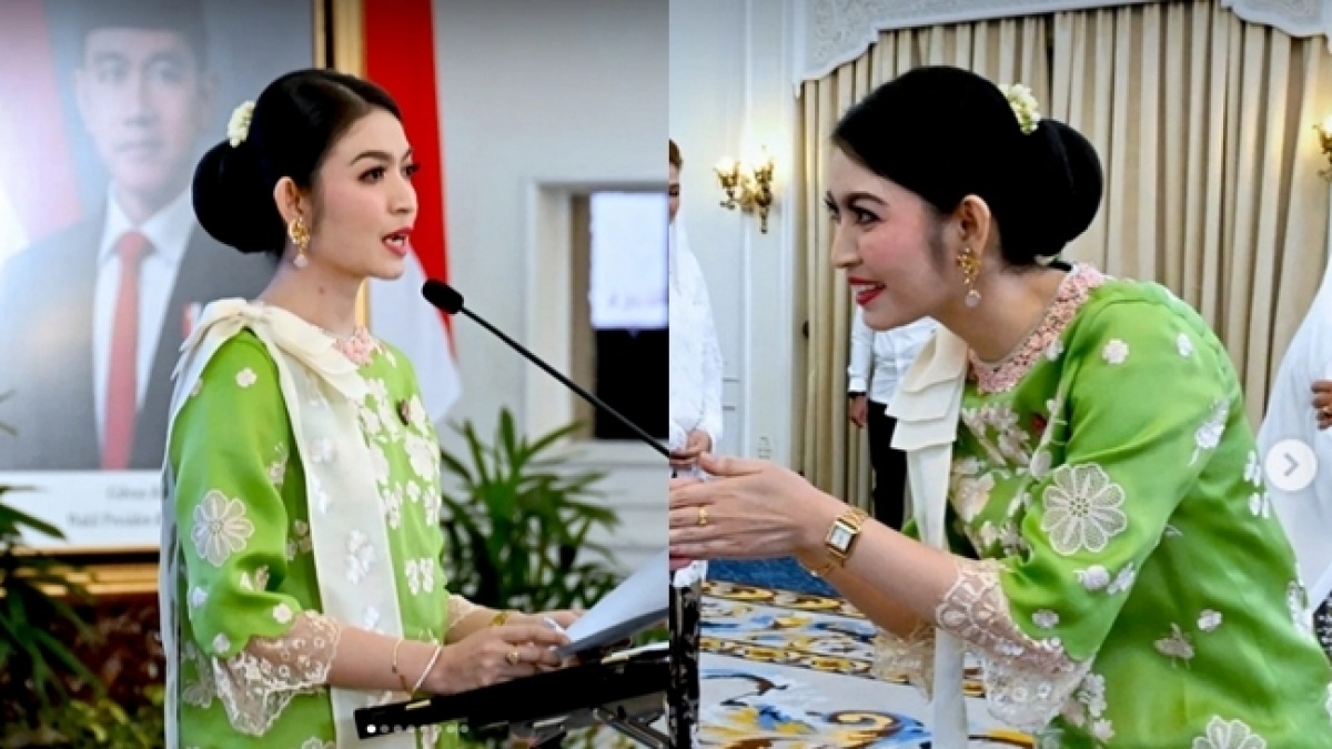 Penampilan Baru Selvi Ananda Pakai Kawat Gigi Jadi Perbincangan