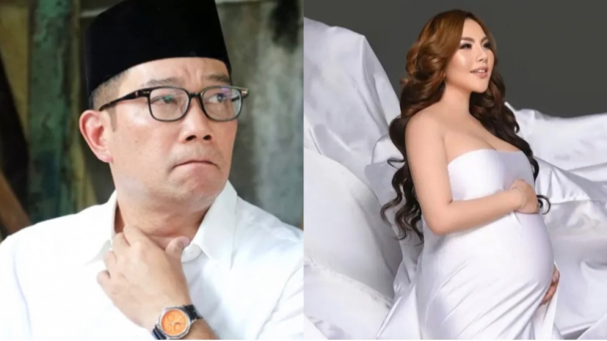 Berapa Biaya Tes DNA? Lisa Mariana Mengaku Siap, Tapi Ngotot Nunggu Ridwan Kamil
