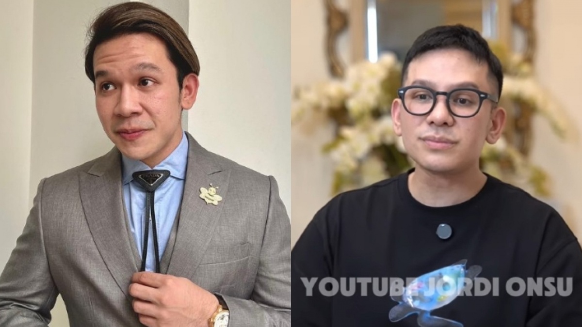 Jordi Onsu Oplas Hidung Sampai Wajah Nyaris Tak Dikenali, Ternyata Segini Biayanya