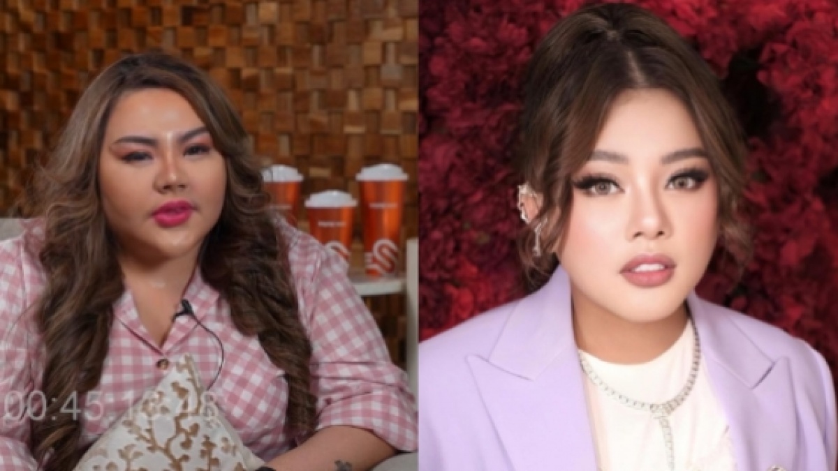 Lisa Mariana Tanya Pengalaman Shindy Samuel Sebelum Operasi Potong Lambung
