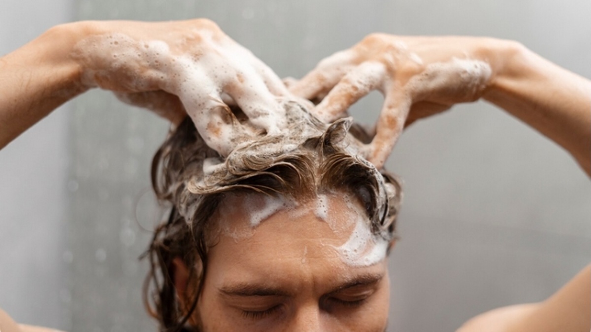 4 Pilihan Sampo Terbaik untuk Mengatasi Kulit Kepala Gatal, Tak Bikin Rambut Kering