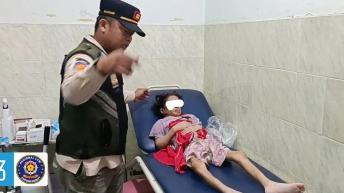 Pernah Dibakar dan Dibacok Ayah Sendiri, Anak Perempuan Di Pasar Kebayoran Lama Jadi Atensi KPPPA