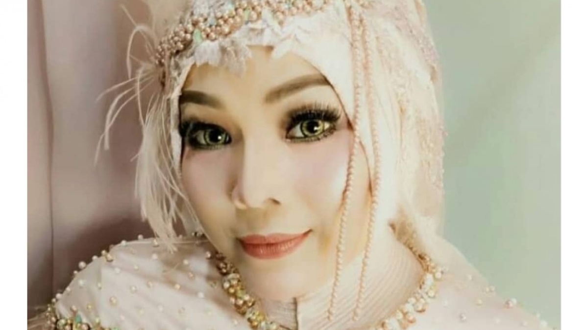 Sebelum Meninggal Dunia, Pedangdut Senior Yunita Ababiel Sempat Jalani Operasi