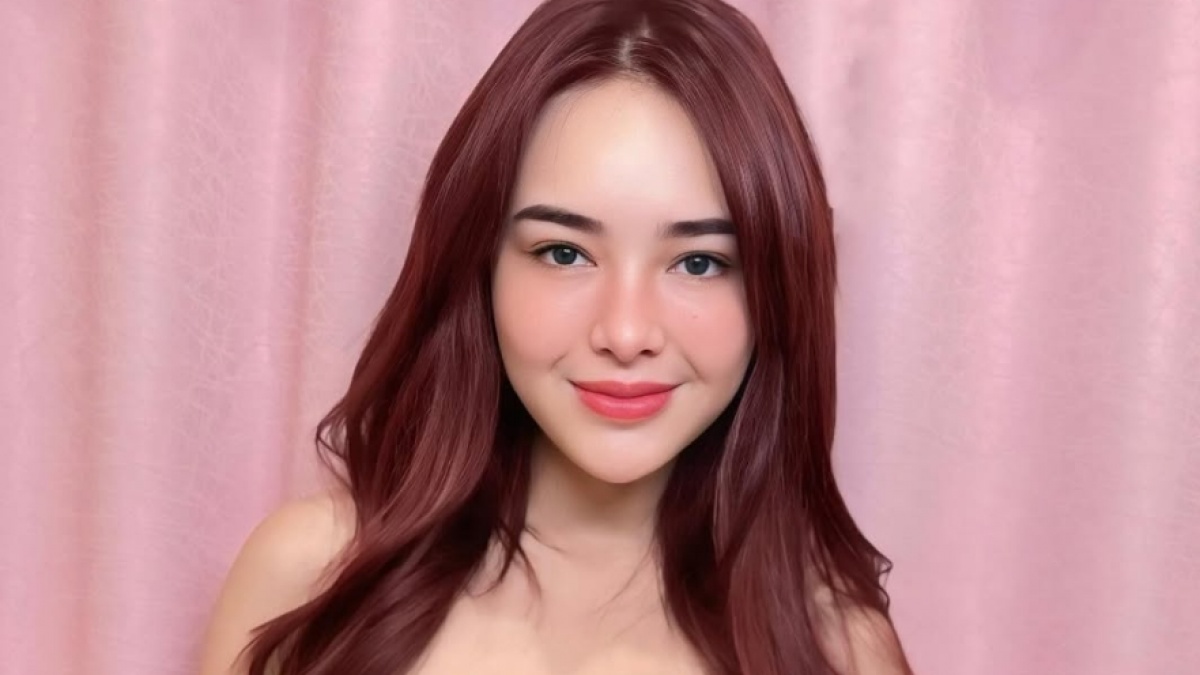 Apakah Amanda Manopo Menjalani Operasi Plastik?