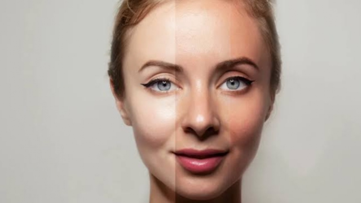 Tak Hanya Pakai Skincare, Ini 5 Cara Efektif Mengatasi Kulit Belang