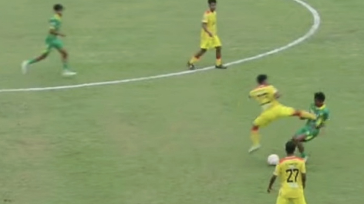 Korban Tendangan Kung Fu Muhammad Hilmi di Liga 4 Buka Suara: Dada Masih Sakit dan Nyeri