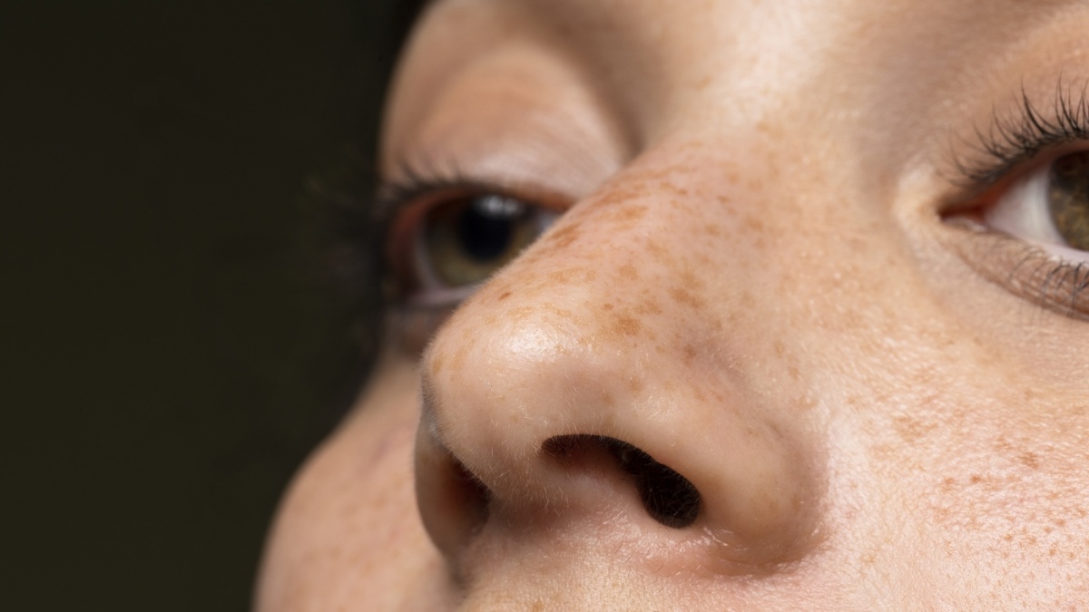 Urutan Skincare Glad2Glow Pagi dan Malam untuk Atasi Flek Hitam di Wajah