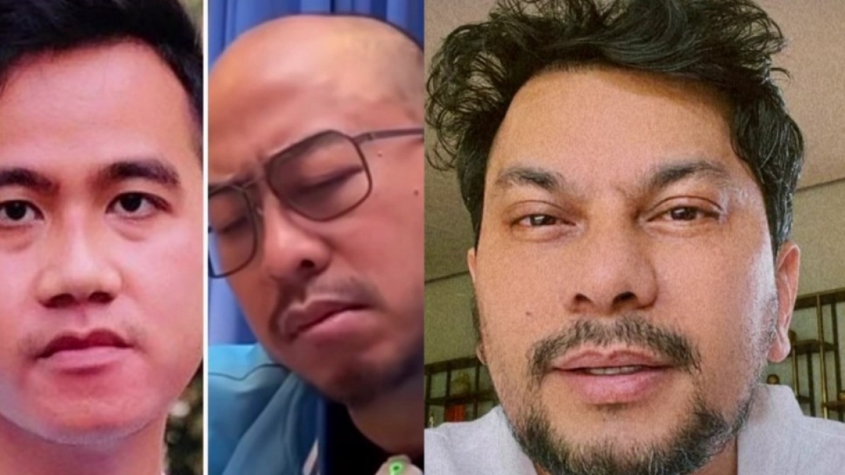 Pandji Singgung Wajah Ngantuk Gibran, Tompi Jelaskan Soal Ptosis: Bukan Bahan Lelucon!