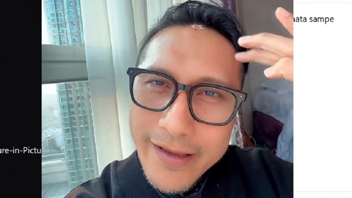 Kepalanya Bocor saat Umrah, Arie Untung: Mungkin Sujudnya Kurang