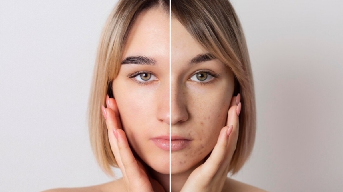 7 Skincare Glycolic Acid untuk Pudarkan Flek Hitam Usia 40 Tahun