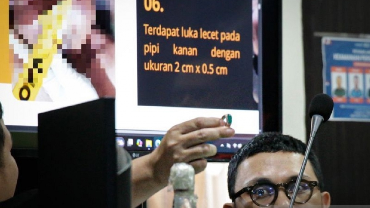Cincin Akik Hijau Jadi Sorotan, Diduga Hantam Wajah Brigadir Nurhadi Sebelum Tewas