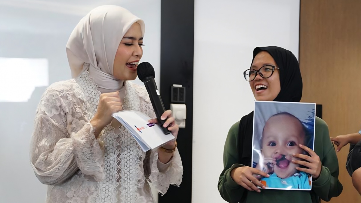 Bibir Sumbing pada Bayi: Penyebab, Waktu Operasi, dan Cara Perawatannya