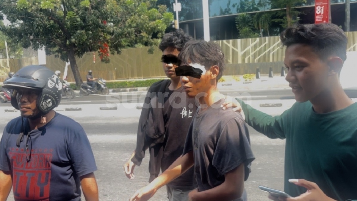 Cerita Siswa MA Pejompongan Dianiaya Kelompok Ngaku Intel, Dipukul Pakai Besi di Depan Rumah