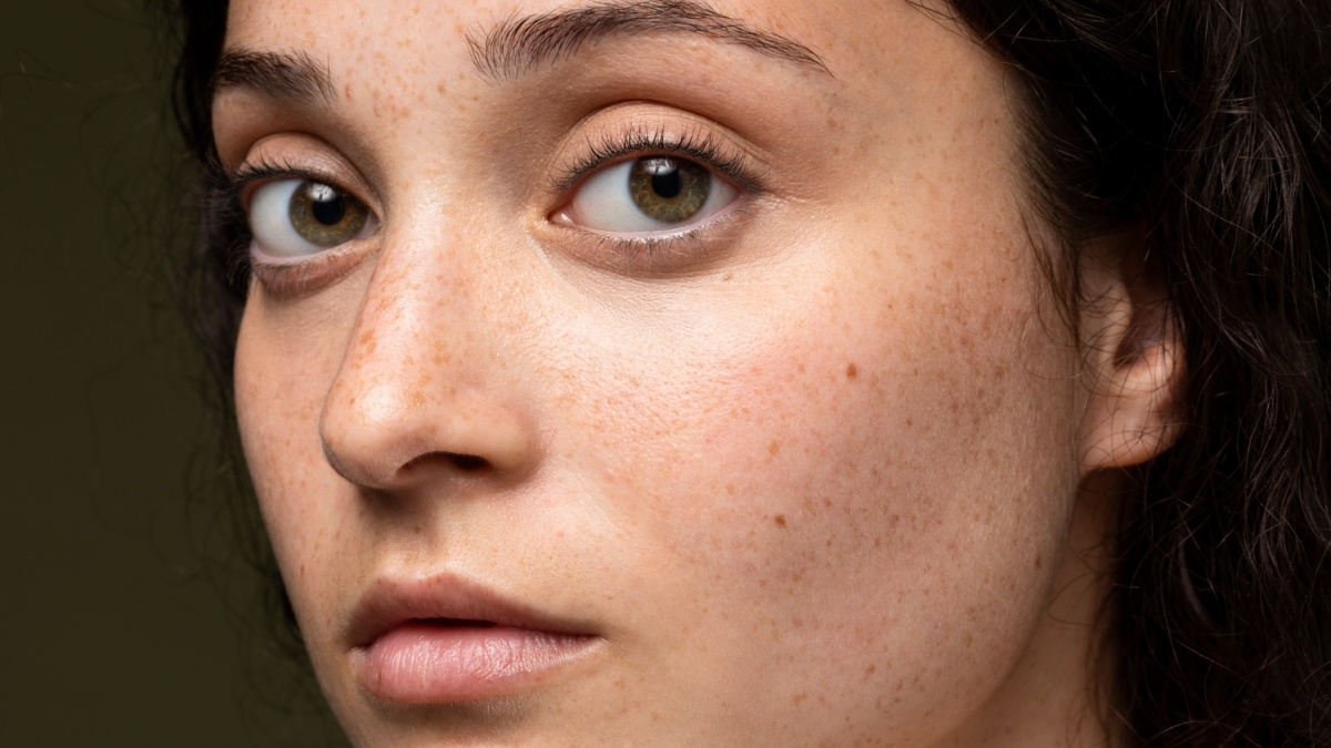 6 Cara Reapply Sunscreen untuk Penderita Melasma tanpa Merusak Makeup