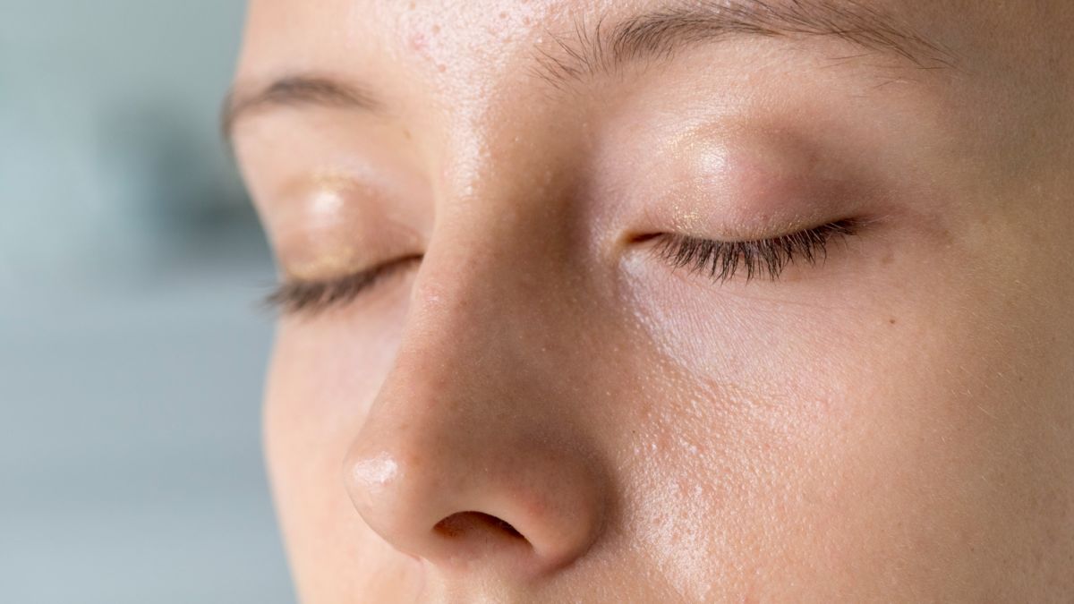 Apakah Viva Retinol Serum Bisa Menghilangkan Milia? Ini Efeknya pada Wajah