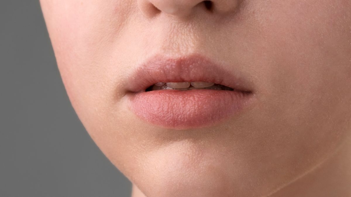 Kenapa Bibir Kering dan Pecah-Pecah Padahal Sudah Banyak Minum?