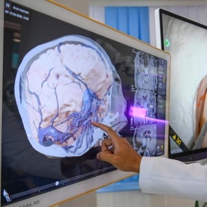 Melihat Layanan Terpadu dan Institut Neurosains RSPON yang Baru Diresmikan