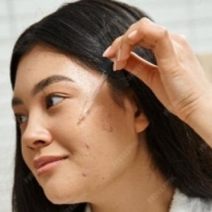 Wajah Muncul Jerawat setelah Lebaran! Ini 4 Acne Serum yang Layak Dicoba