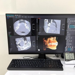 Mengenal Rontgen Gigi 3D: Teknologi yang Bantu Diagnosis Lebih Akurat dan Cepat