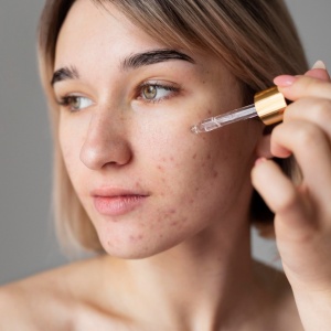 6 Cara Menetralkan Kulit Wajah yang Perih Akibat Salah Pilih Serum, Cegah Iritasi Makin Parah