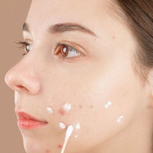 Pakai Obat Totol Jerawat Sebelum atau Sesudah Moisturizer? Ini Urutan yang Tepat