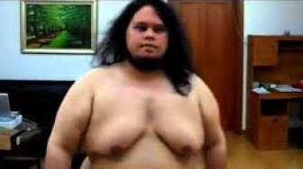 Video: Wow, Lelaki Ini Berhasil Hilangkan 75 Kg Lemak di Tubuhnya