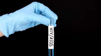 Ditemukan Varian Baru HIV Virus VB Lebih Melemahkan Tubuh dan Lebih Cepat Nular