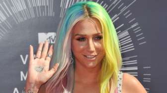 Kesha Akhirnya Diizinkan Meriahkan Billboard Music Awards 2016