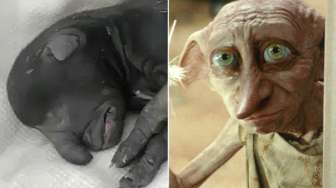Wajah Anjing Ini Mirip Dolby "Harry Potter"