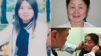 Berusia 29 Tahun, Perempuan Ini Tampak Seperti 80 Tahun