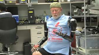 VIDEO: Lelaki Disabilitas Ini Miliki Tangan Robot