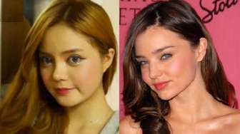 Ingin Mirip Miranda Kerr, Perempuan Ini Operasi Wajahnya