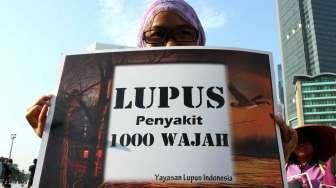 Anak Didiagnosis Lupus, Ini Hal yang Harus Dilakukan Orangtua