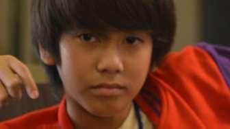 Ini 'Cacat' yang Dialami Iqbaal CJR akibat Kecelakaan Motor