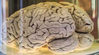 Lelaki Ini Menjual Otak Manusia di eBay