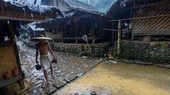 23 Warga Baduy Dalam Terjangkit Frambusia