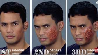 VIDEO: Belajar Bikin SFX Make-up Luka Bakar Yuk!